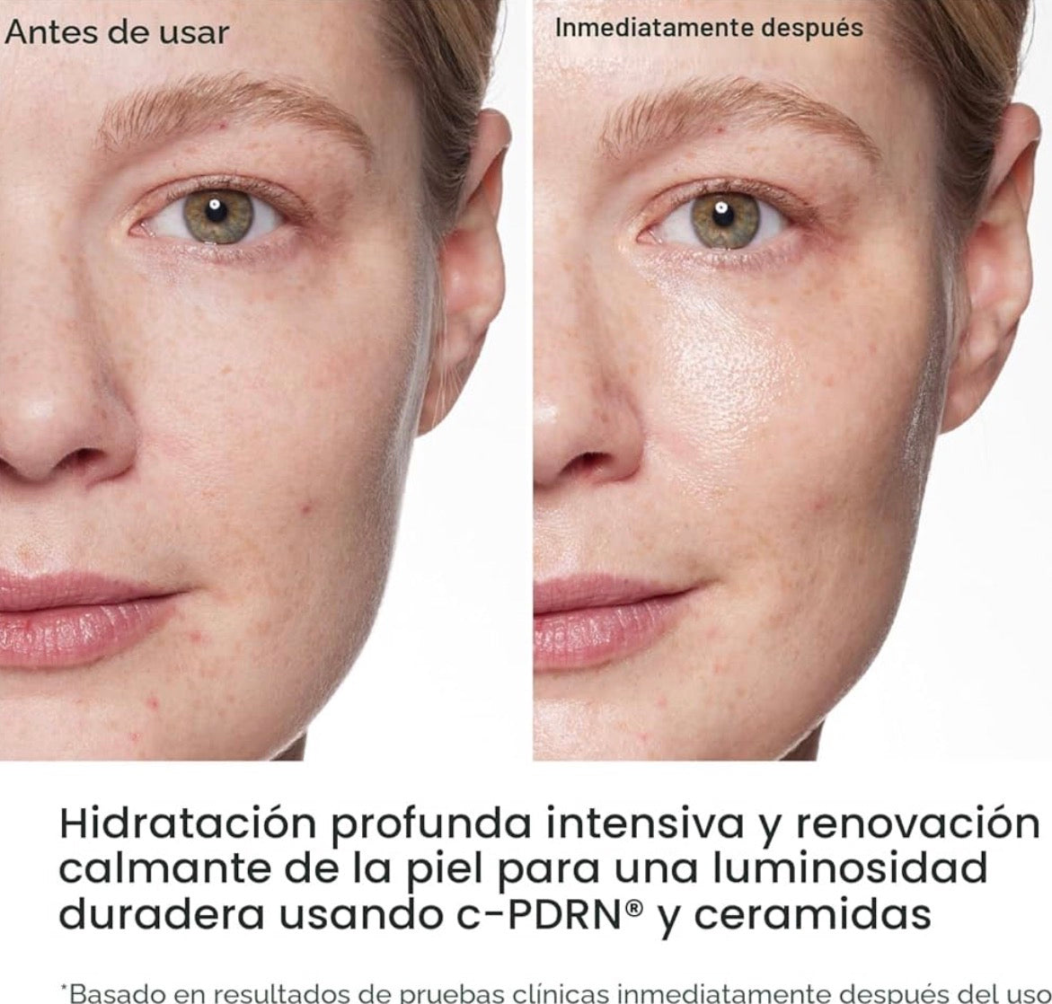 REJURAN Máscara de Renovación c-PDRN (5und)