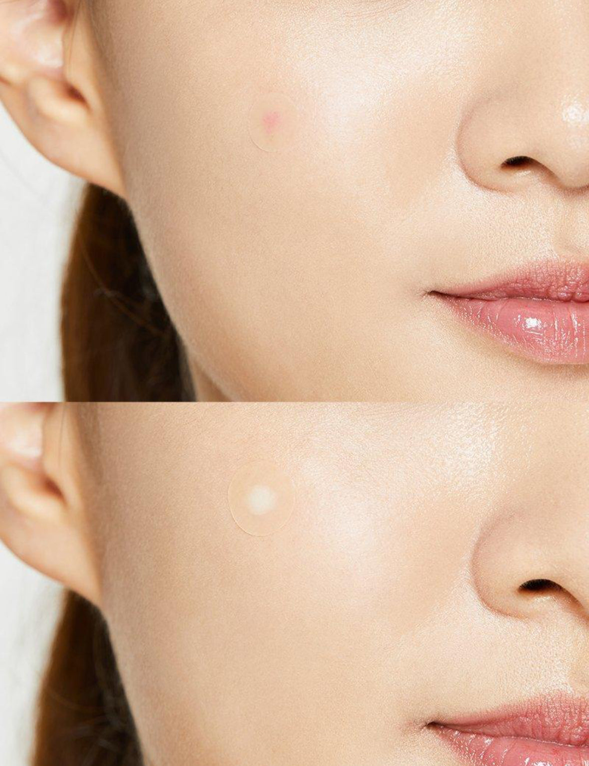 Acne Pimple Master Patch